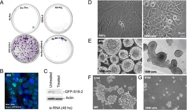 Олена Кашуба разом із колегами показала, що один із них (MRPS18-2) може наділяти клітини властивостями стовбурових клітин